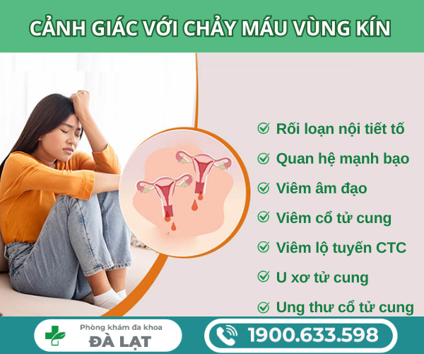 Hình ảnh minh họa